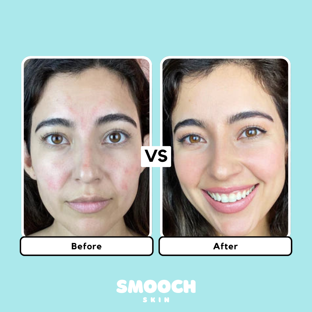 Smooch Skin Handset